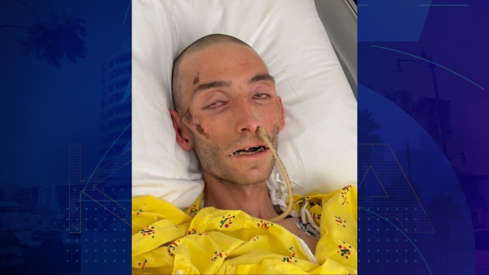 Los Angeles Hospital Seeks Help Identifying Man Found Unresponsive