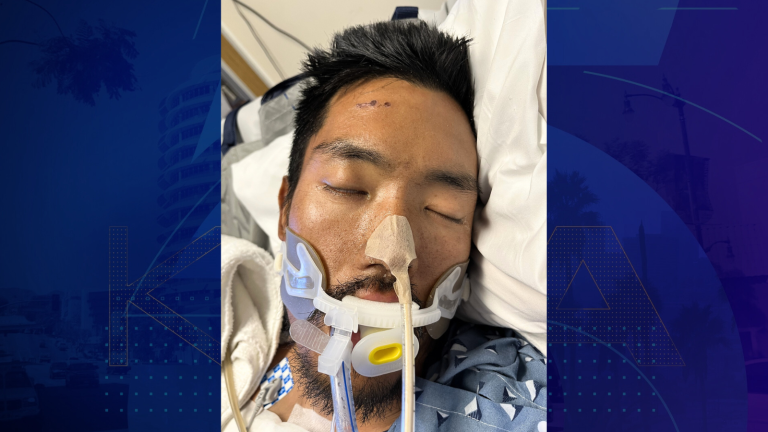 Hospital Seeks Public’s Help to Identify Man Found Unconscious in Los Angeles